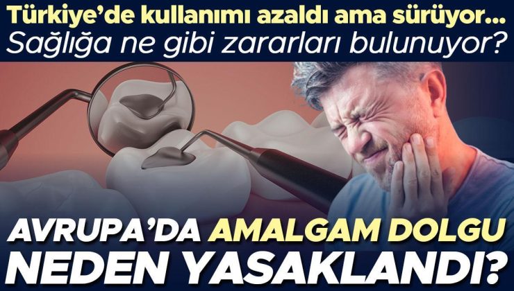 Avrupa’da Amalgam dolgu neden yasaklandı? Türkiye’de kullanımı azaldı ama sürüyor… Sağlığa ne gibi zararları bulunuyor?