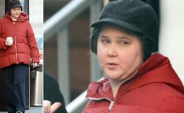 Herkes ünlü yıldızın yüzüyle alay etmişti: Altından ciddi bir hastalık çıktı