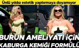 Estetik yaptırmaya doyamadı… Burnunu yapmak için kaburgasından alınan kemiği kullanacaklar
