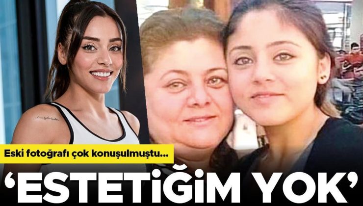 Ünlü oyuncunun değişimi dikkat çekmişti… ‘Estetiğim yok!’